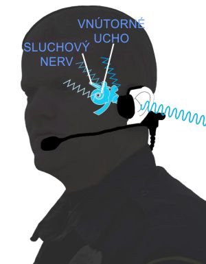 IMPRES náhlavná súprava